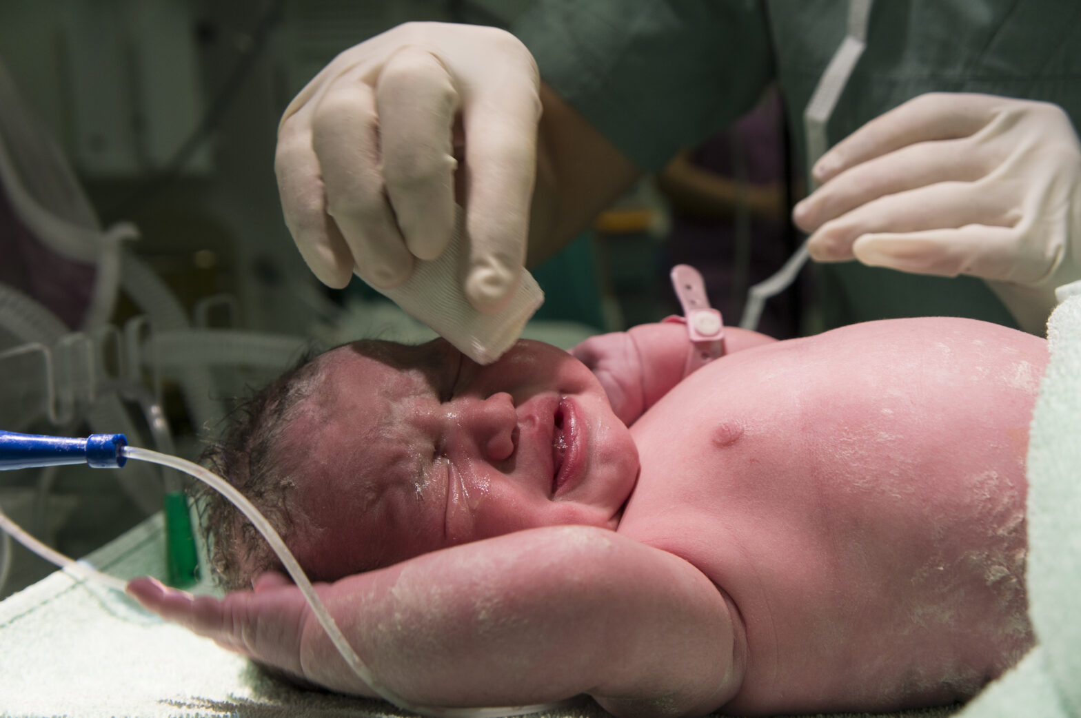 The Role of Neonatologists in the NICU - Savera Child Clinic