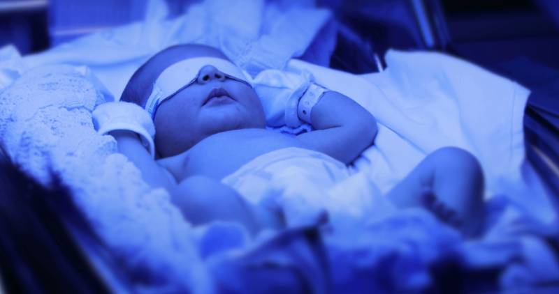 Neonatal Jaundice Management
