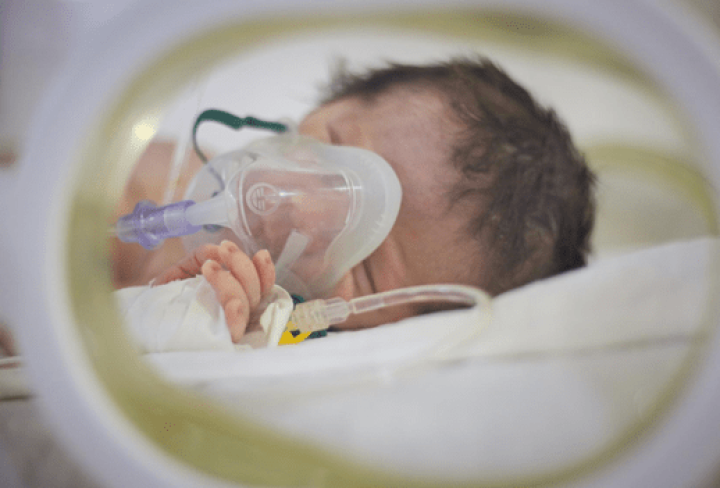 Neonatal Sepsis & Breathing Support