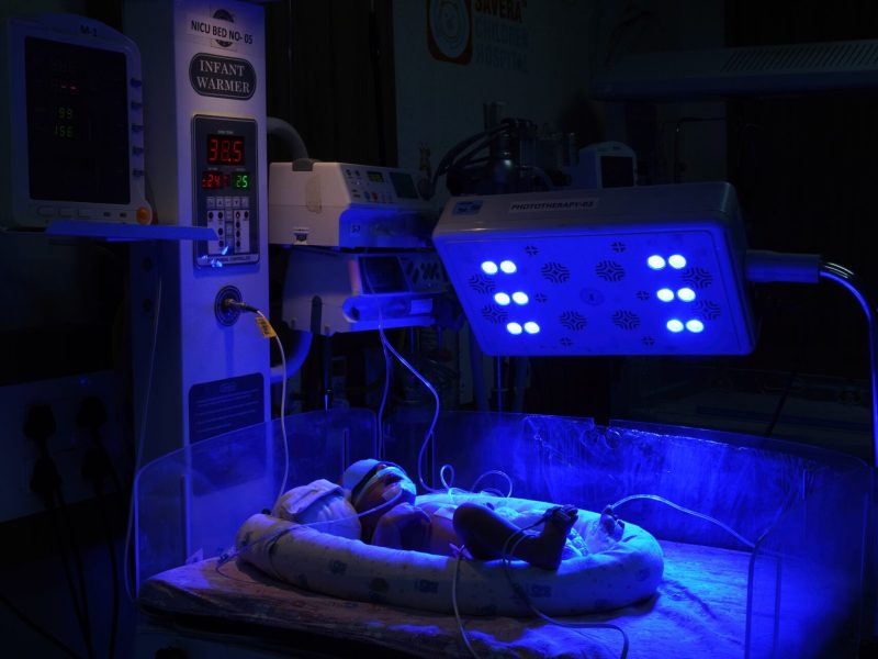 Phototherapy for Neonatal Jaundice - Savera Children Hospital
